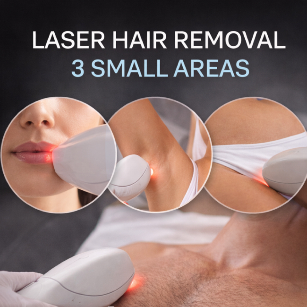 3 Small Areas (Laser Hair Removal) at Glenn Luxe Studio in Miami, FL