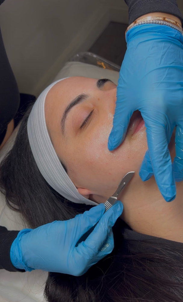 Dermaplaning
