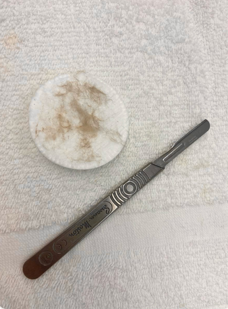 Dermaplane