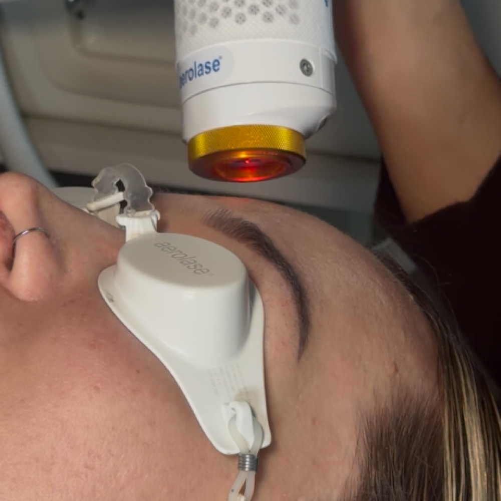 Kind Reset at Kind Esthetics in Spring, TX