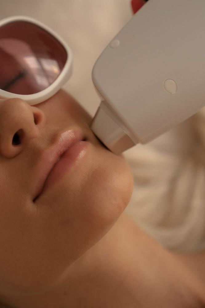 Laser Rosto Todo/ Full Face
