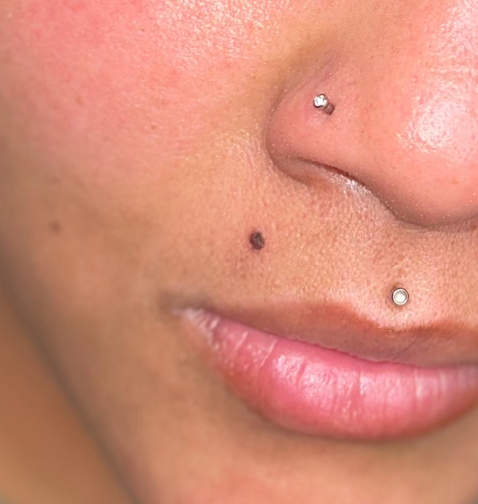 Beauty Mark