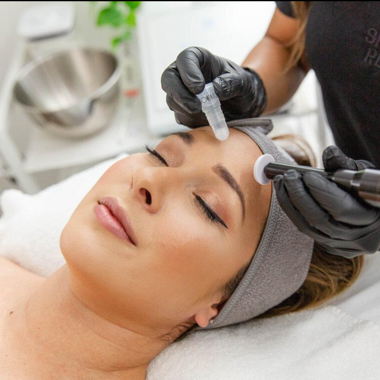 ProCell Microchanneling - Face at Aesthetics by Aunnie in Costa Mesa, CA