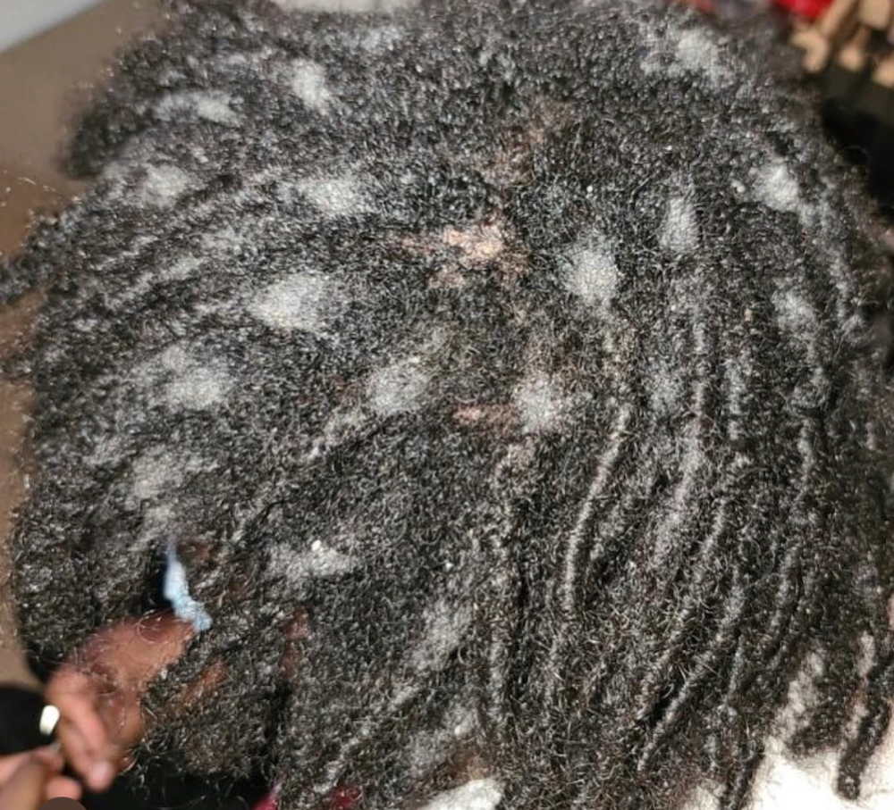 Loc Detox/ Build Up Removal