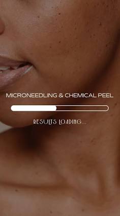 Microneedling + Peel