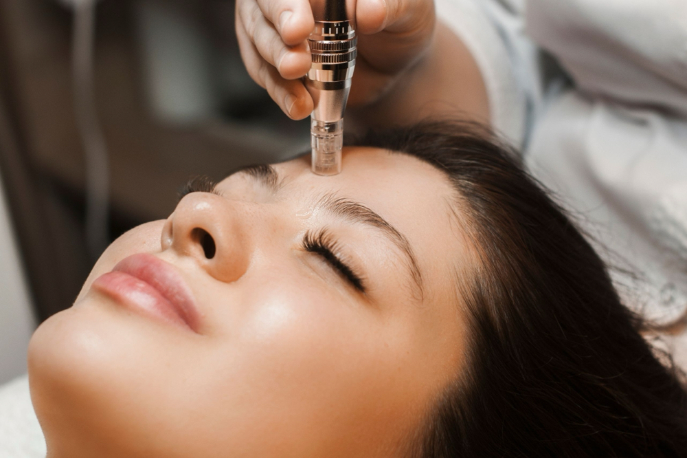 Microneedling Face Neck & Décolleté at Leidy Bedoya in Methuen, MA