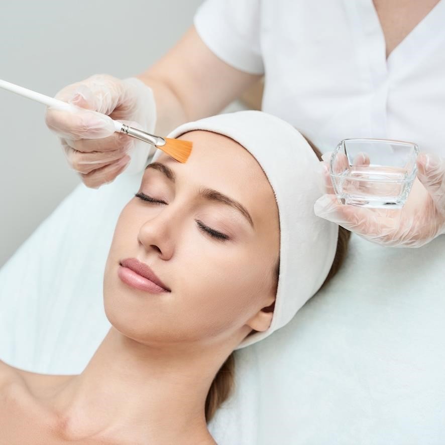 Chemical Peel (Lactic)