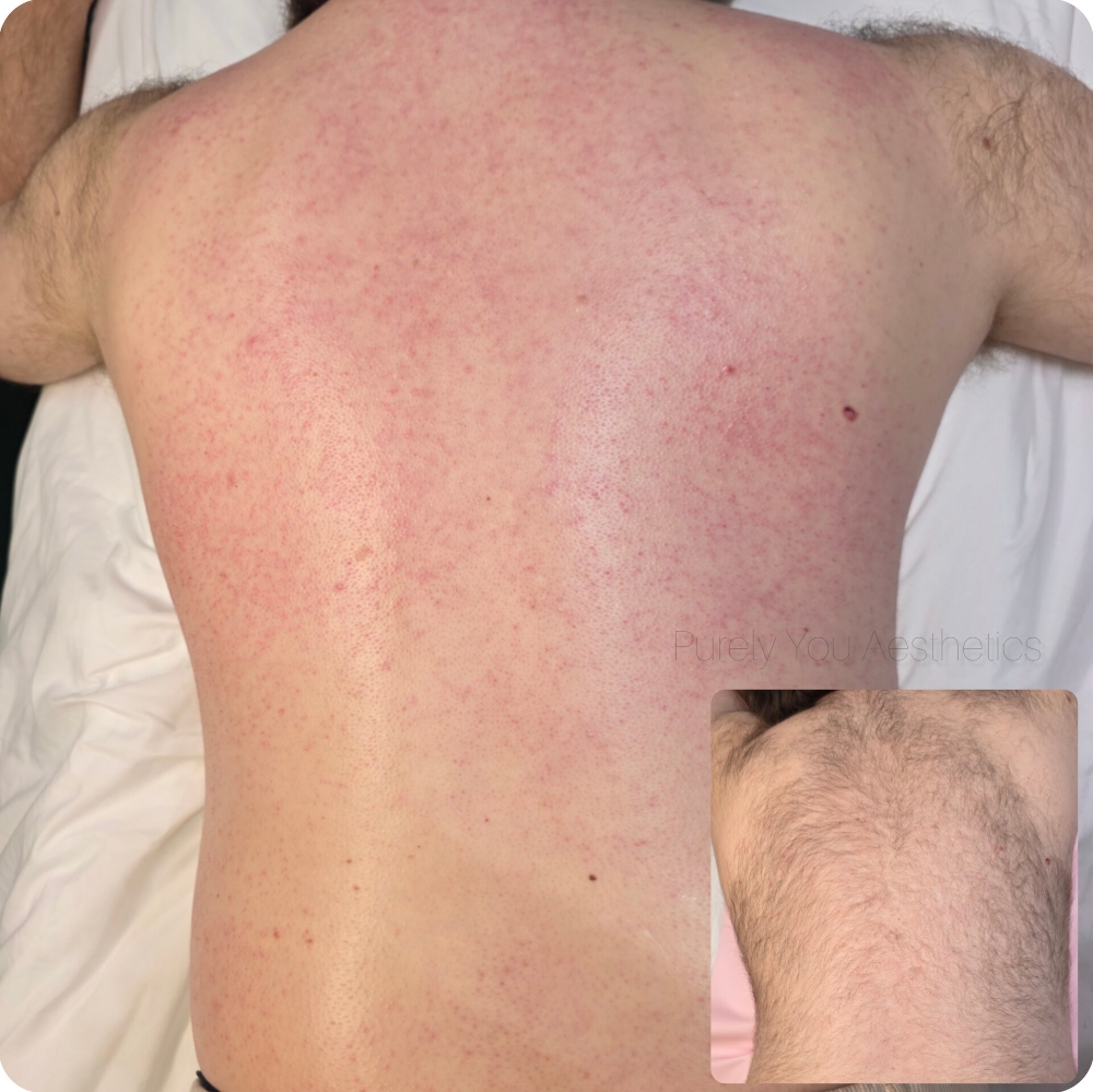 Full Arm, Leg, or Back wax