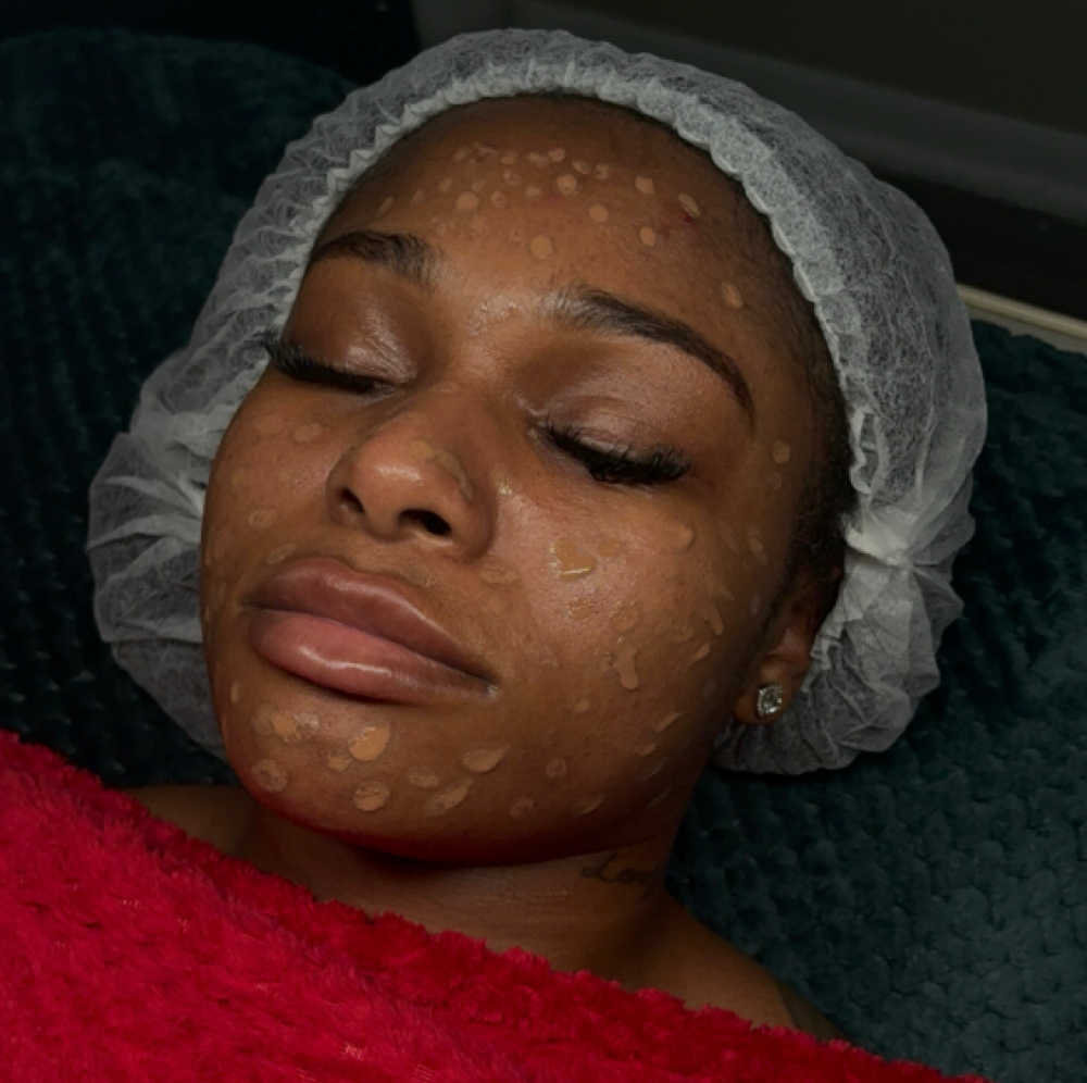 BELLEZA GLOW (BBGLOW) at Belleza Skin in Tinley Park, IL