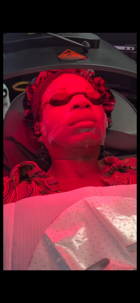 LED Light Therapy Add -on Service