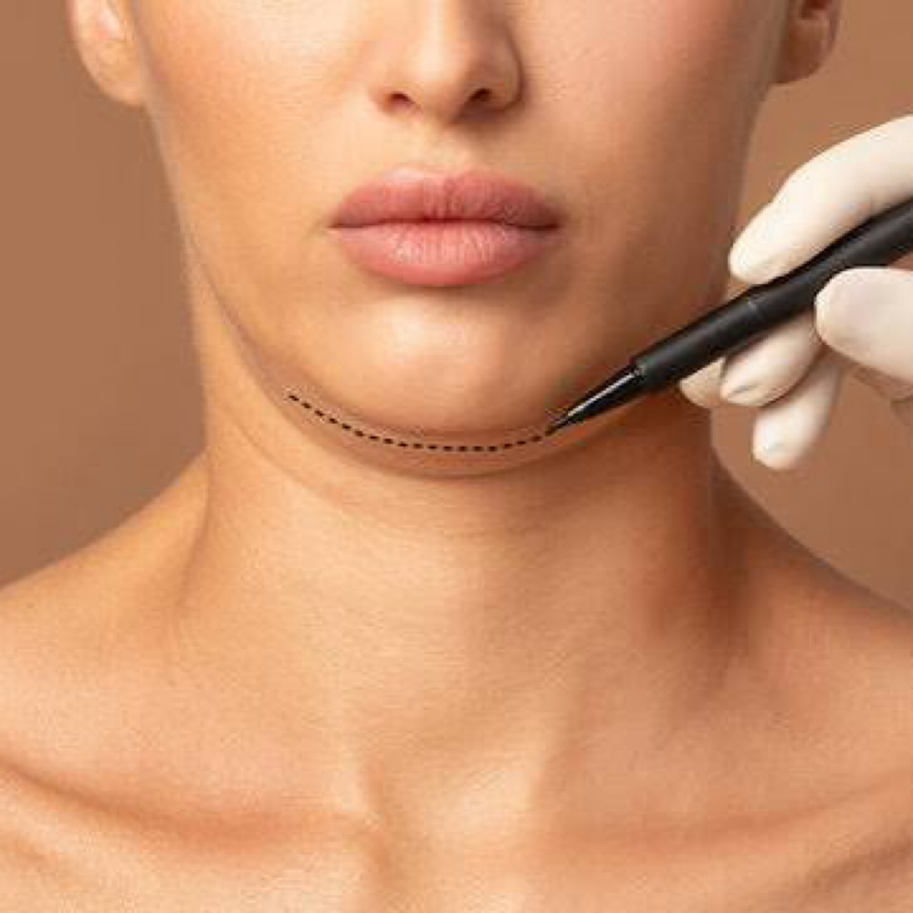 Double Chin Sculpt at Ipanema Skincare in St Charles, IL