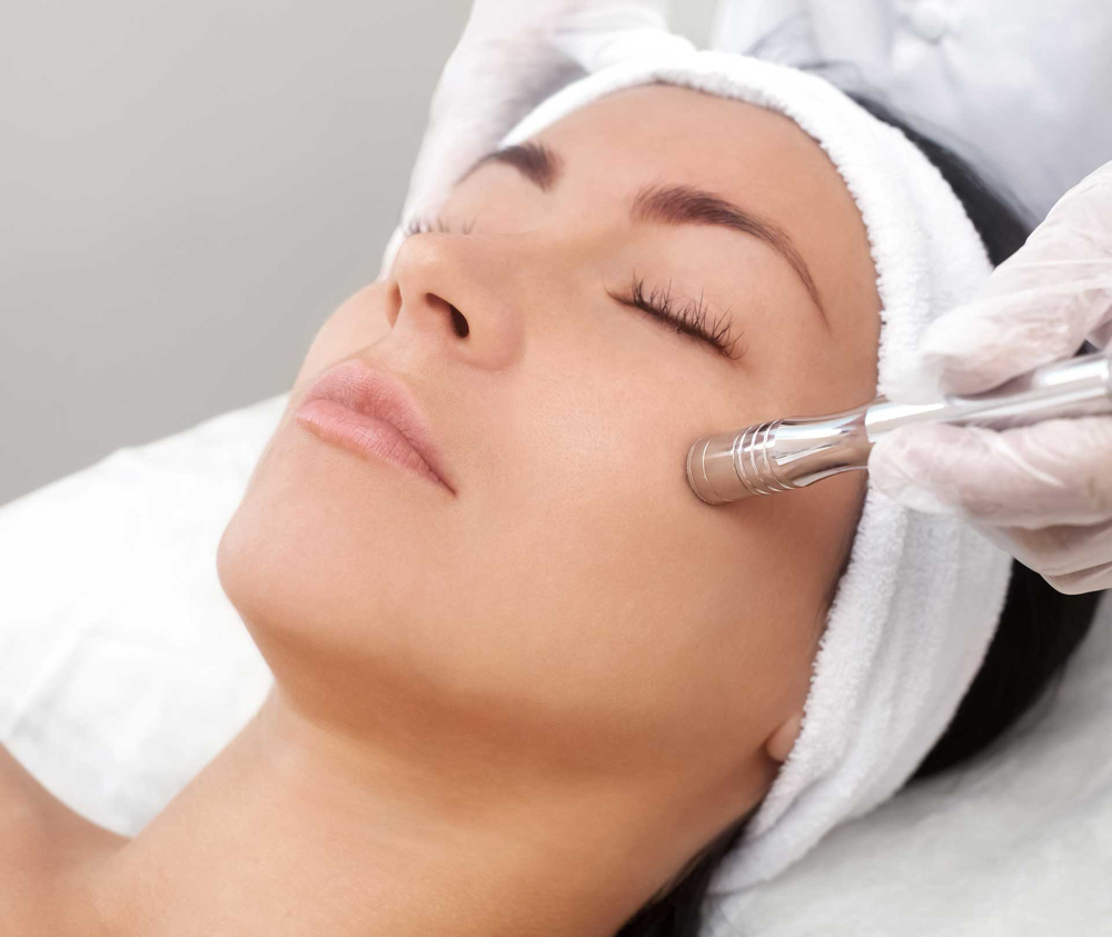 Microdermabrasion Facial