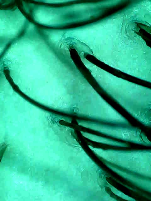 Scalp Camera and HeadLab treatment
