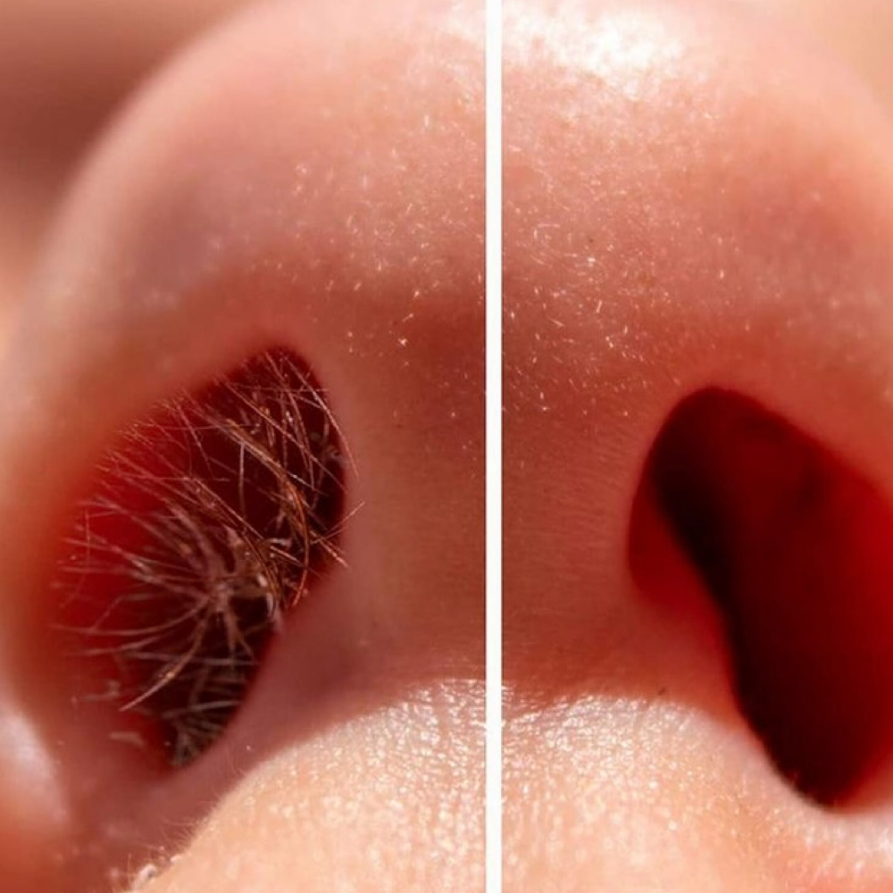 Nose Wax at Sunny Wax & Beauty in Brookfield, WI