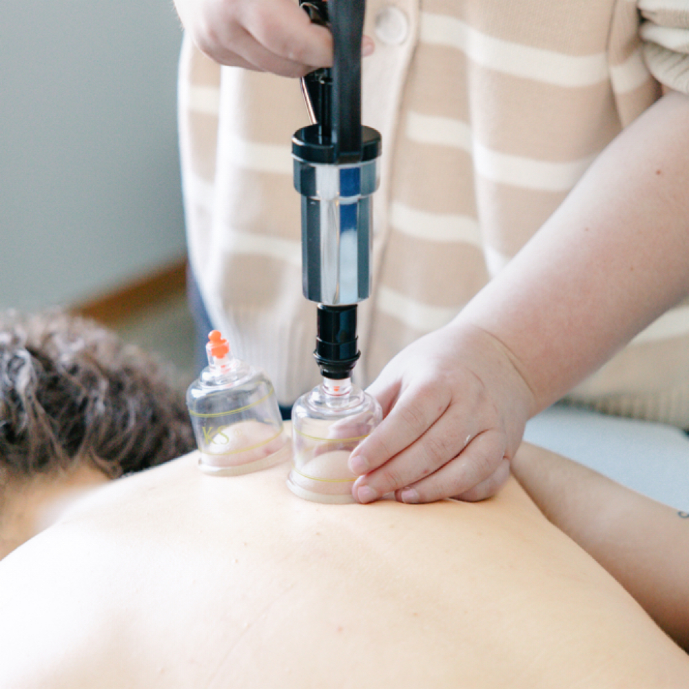Cupping Therapy at Massage Therapy By Kayla in Park Rapids, MN