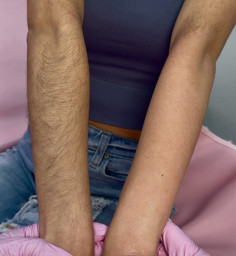 Half Arm Wax at Rose Beauty Bar | LLC in Lewisville, TX