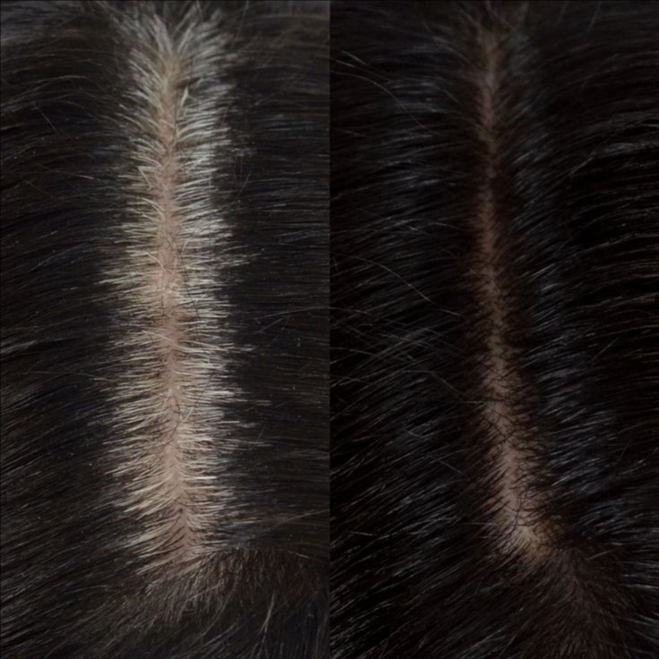 Root Retouch at Allison  Alvarado in Brownsville, TX