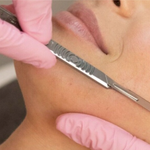 Express Dermaplane Treatment at Ethical Esthetics in Bedford, NH