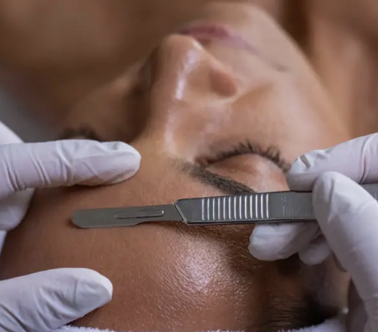 Add on Dermaplanning
