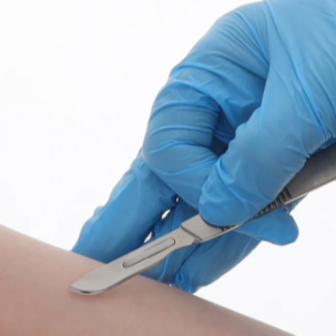 Dermaplane Arm Renewal at Embrace Aesthetics in AURORA, CO