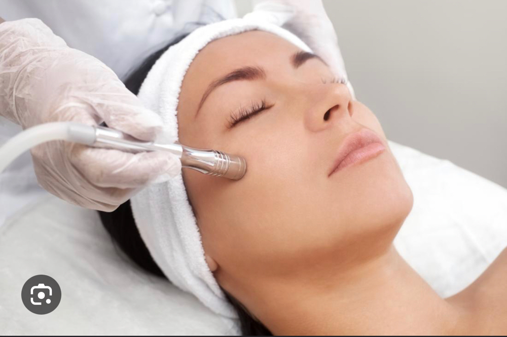 Microdermabrasion