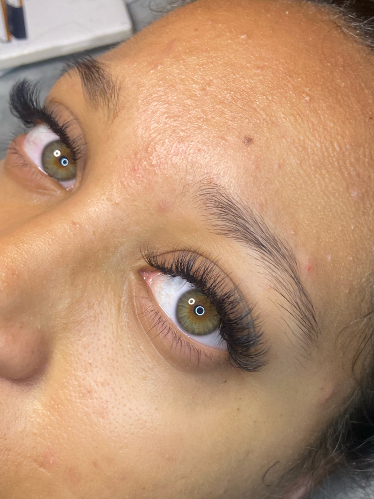 Hybrid Refill