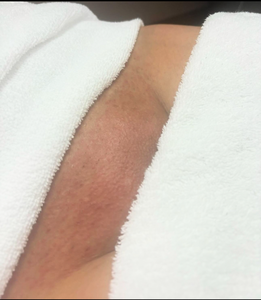 Bikini Wax