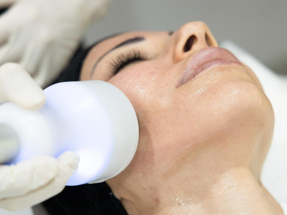 Cryotherapy Facial