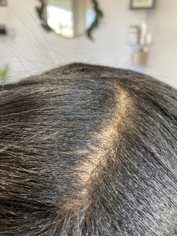 Scalp Refresher