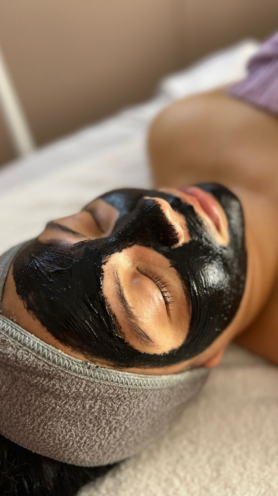 Acne Free Express at Beauty & Esthetics by Sol Luna in Inglewood, CA