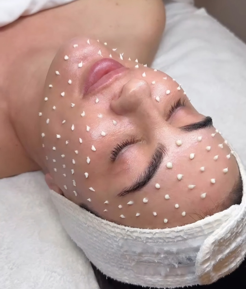 Cellstory Liquid Microneedling