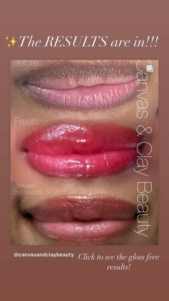 Lip Neutralization Package