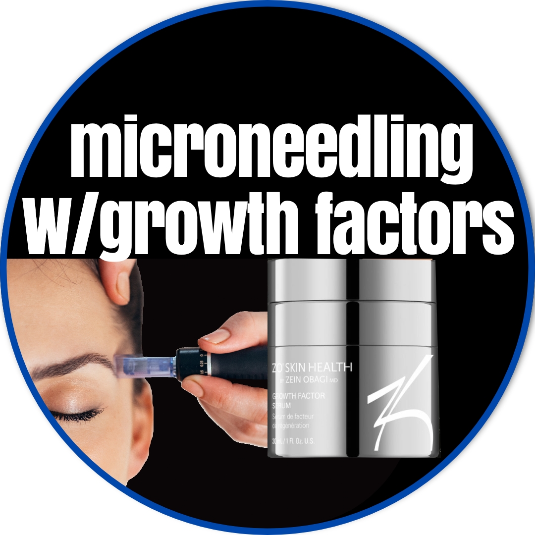 Microneedling with Growth Factors