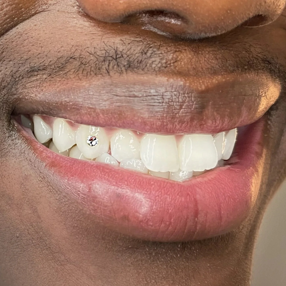 Single Tooth Gem