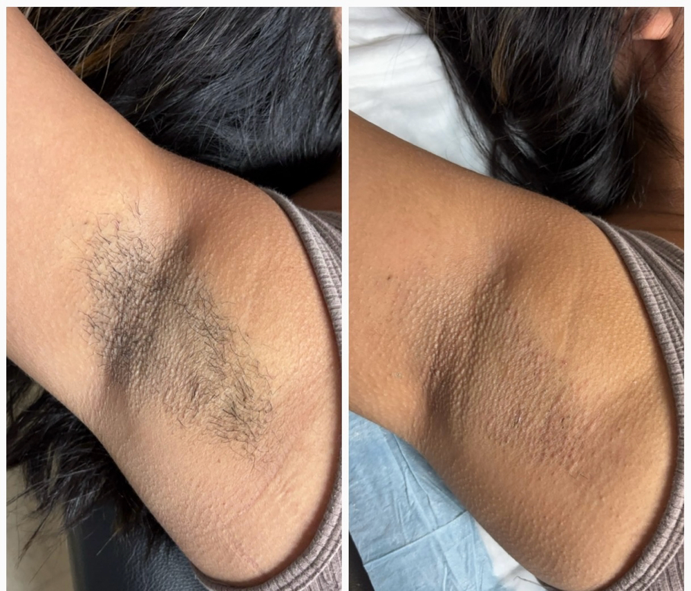 Under arm wax