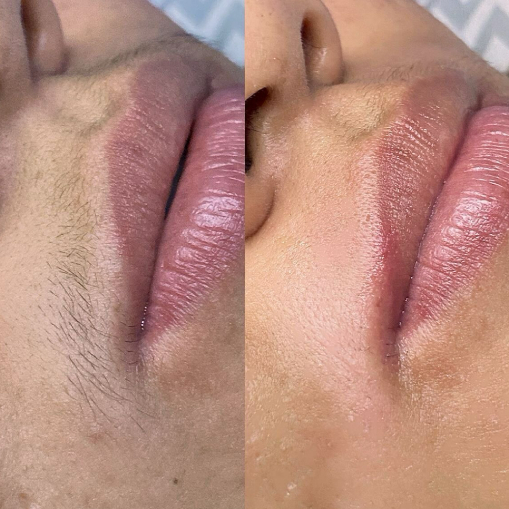 Upper Lip Wax at BR_BEAUTY in Corpus Christi, TX