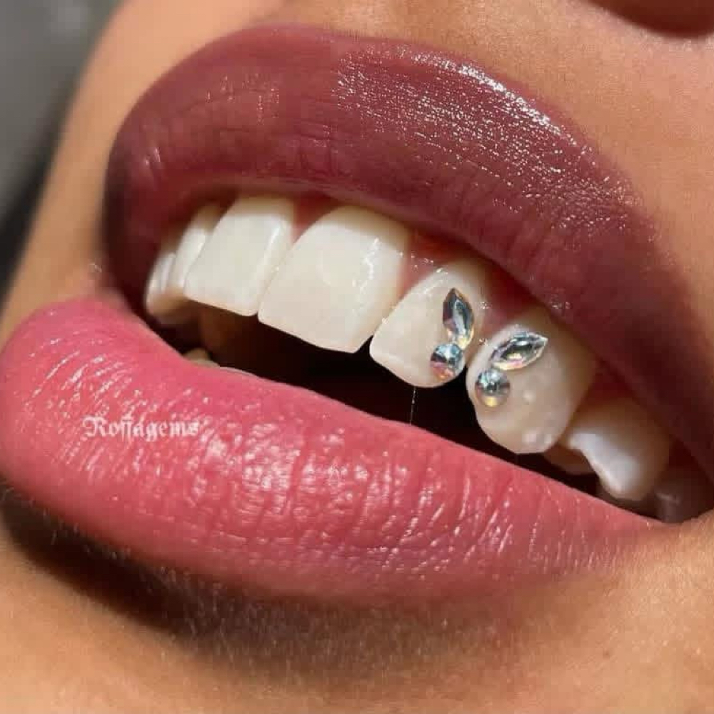 Tooth Gem at ARock Beauty & Wellness in San Angelo, TX