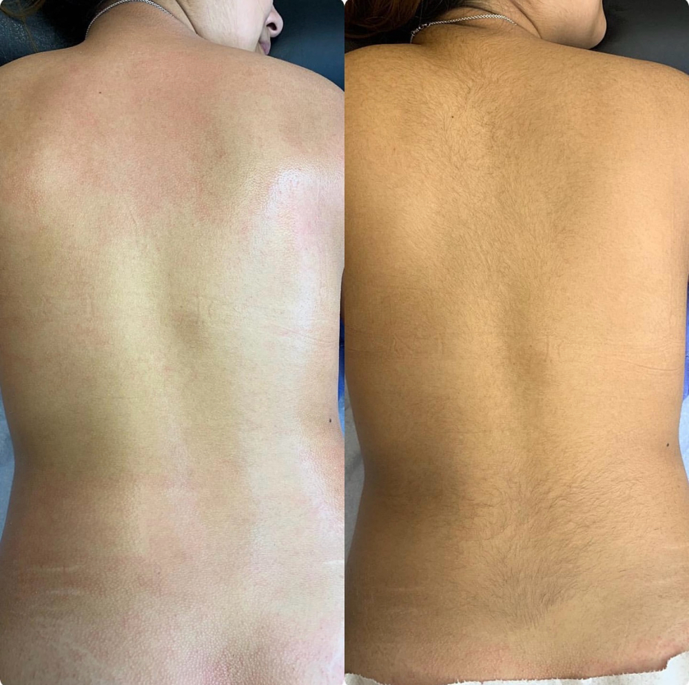 Full Back Wax