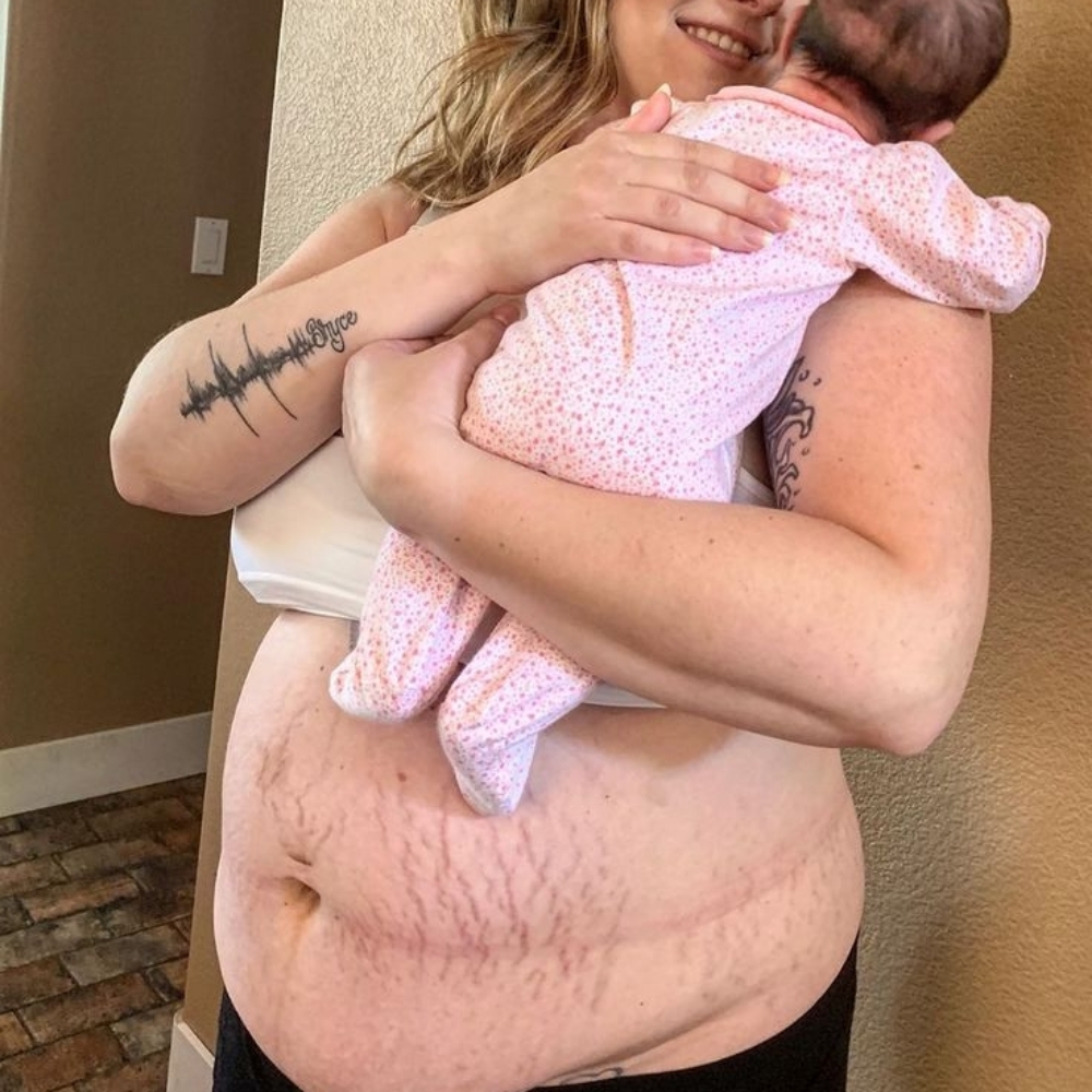 POSTPARTUM BODY RESET at D'Yalorde Wellness & Aesthetics LLC in El Paso, TX