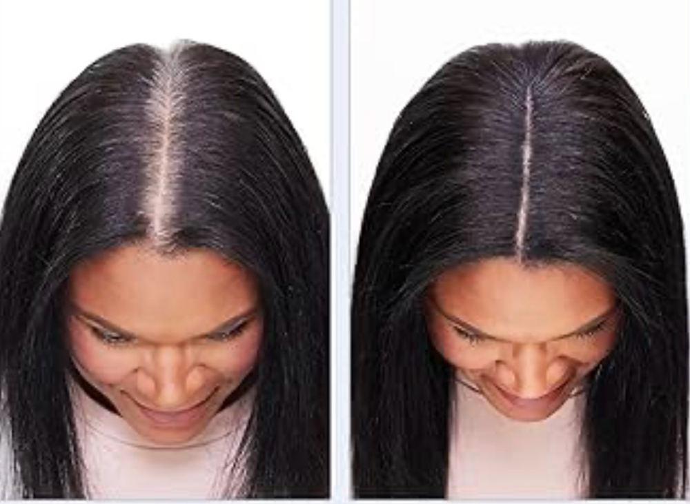 Regrowth/ Grey Coverage