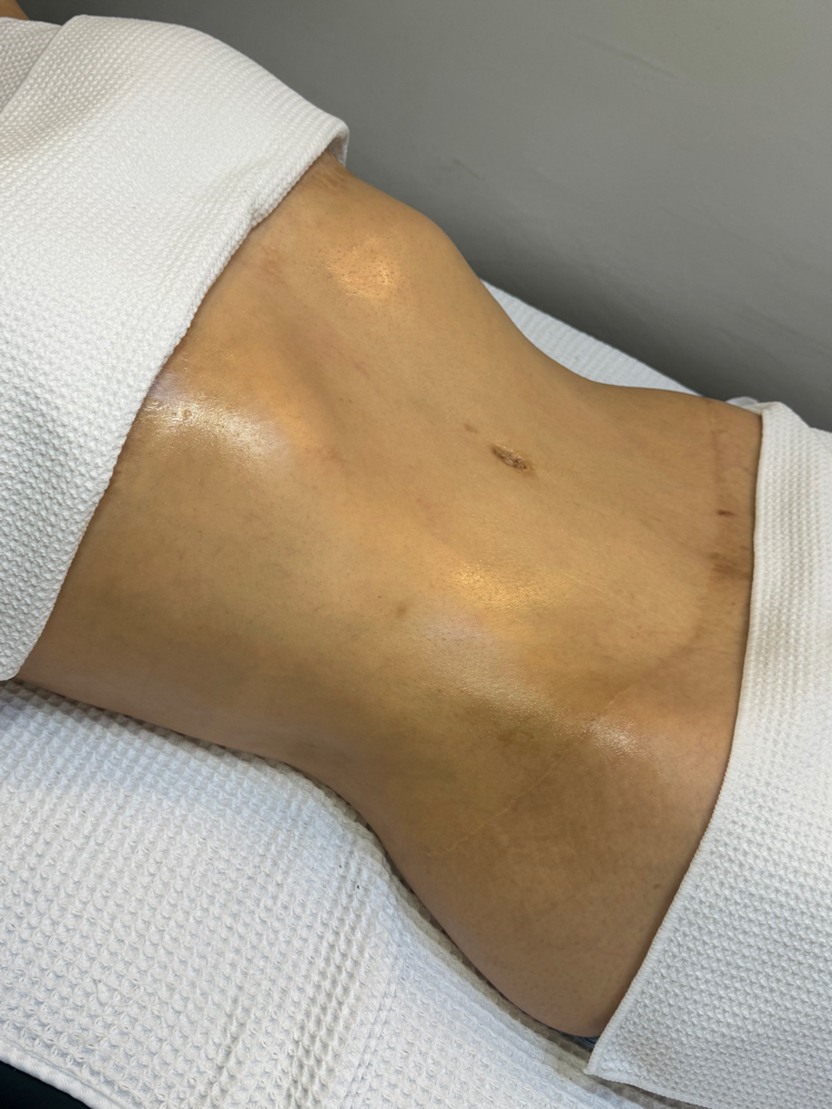 Full Body Lymphatic
