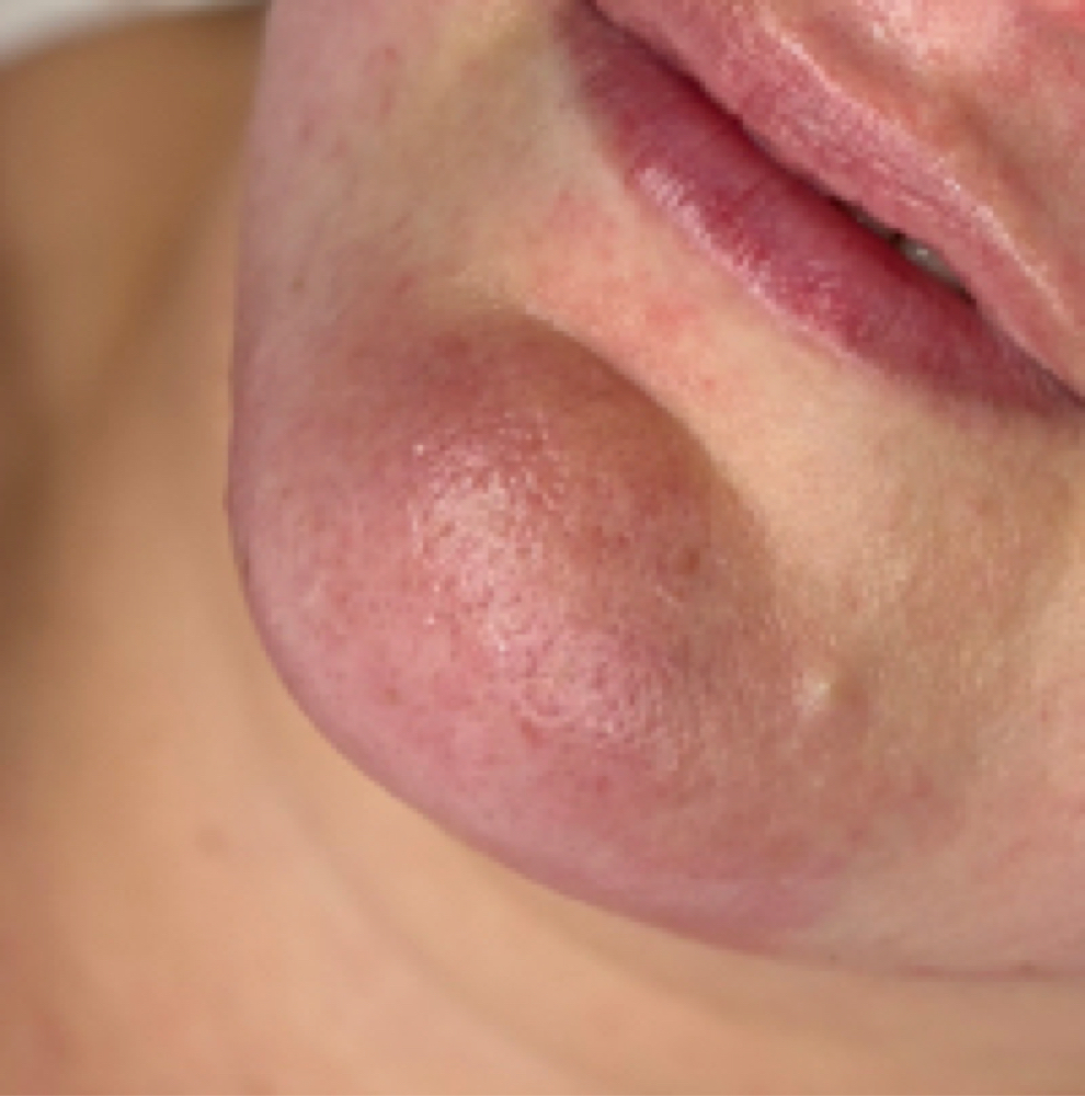 Chin Wax at Bare by Kelsey in Gaylord, MI