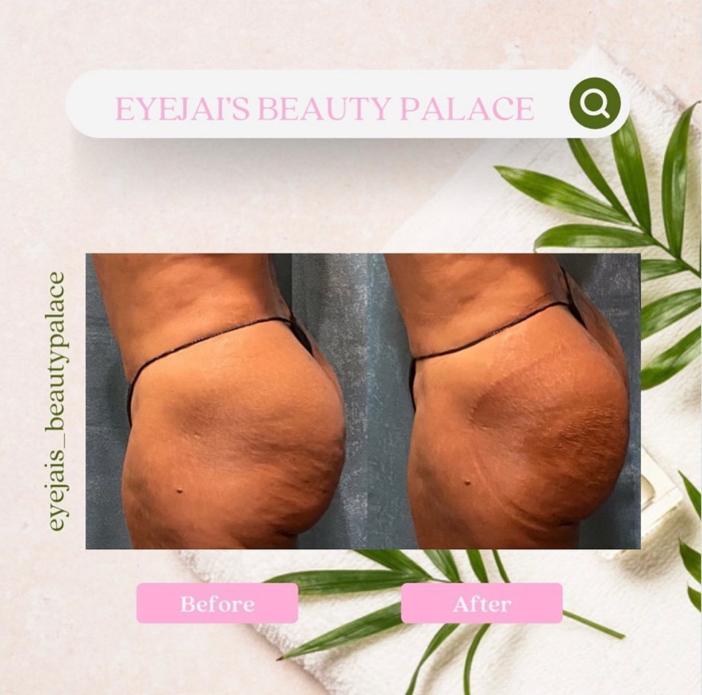 Derrière Enhancement~BBL