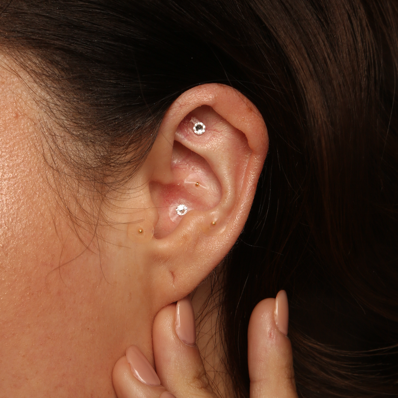 Ear Seeds Follow Up