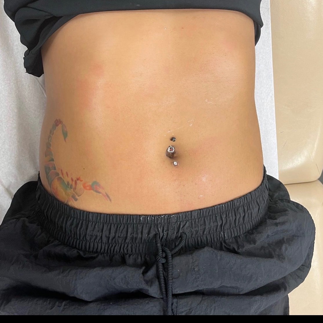 Stomach wax at BarebyMari in Port Saint Lucie, FL