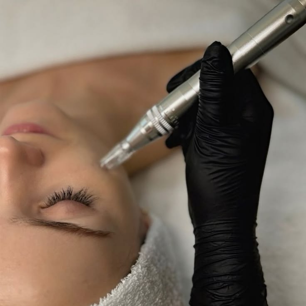 Cosmetic Microneedling Add-On at Moore Realistic in Houston, TX
