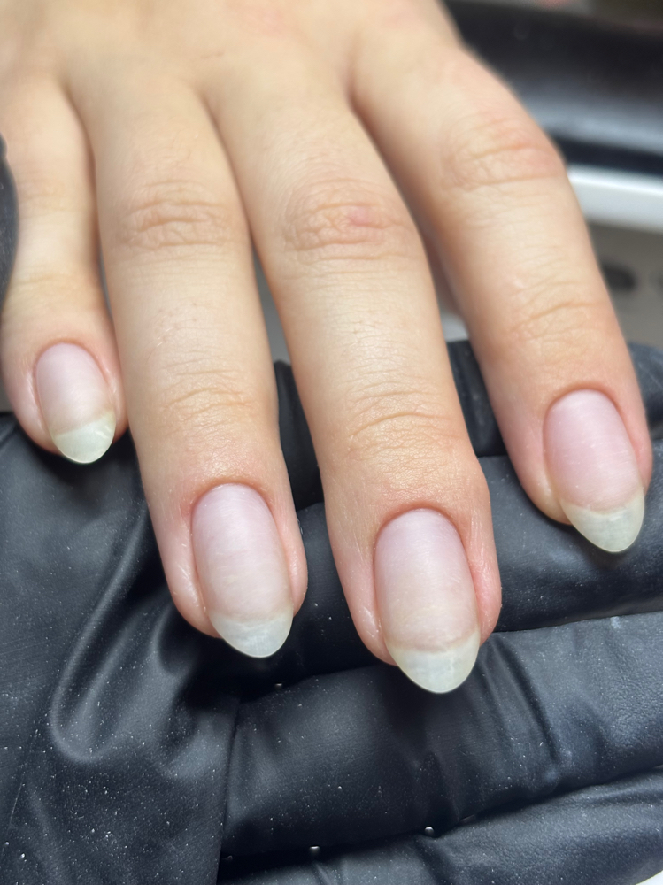 Acrylic Overlay