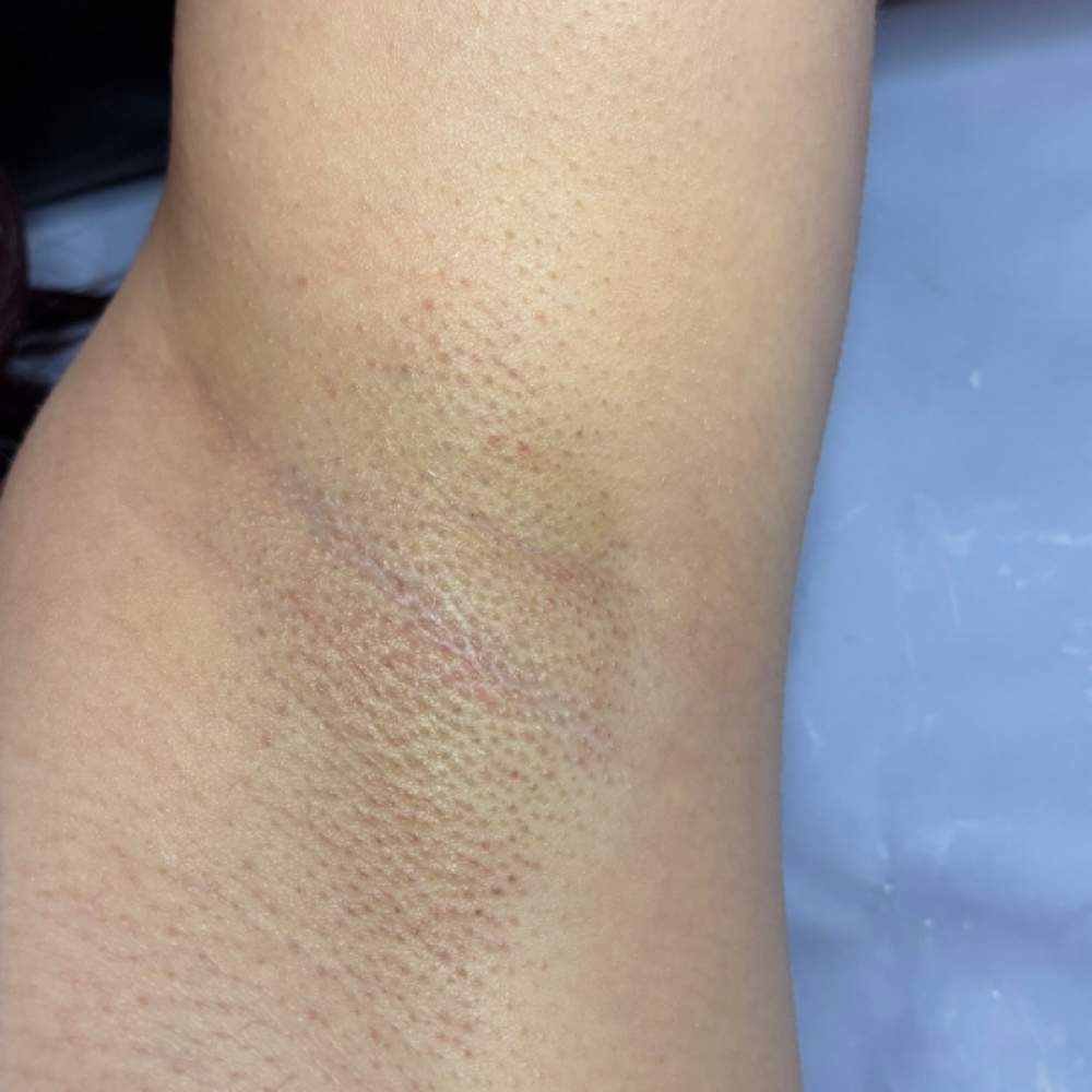 💣 Underarm Wax at B Bomb Beauty Esthetics in Wichita, KS