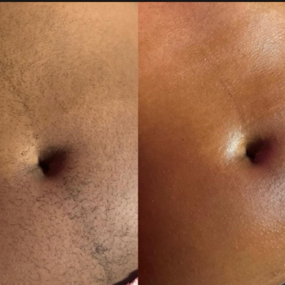 Stomach at Nouvèl Beauty Collective in New London, CT
