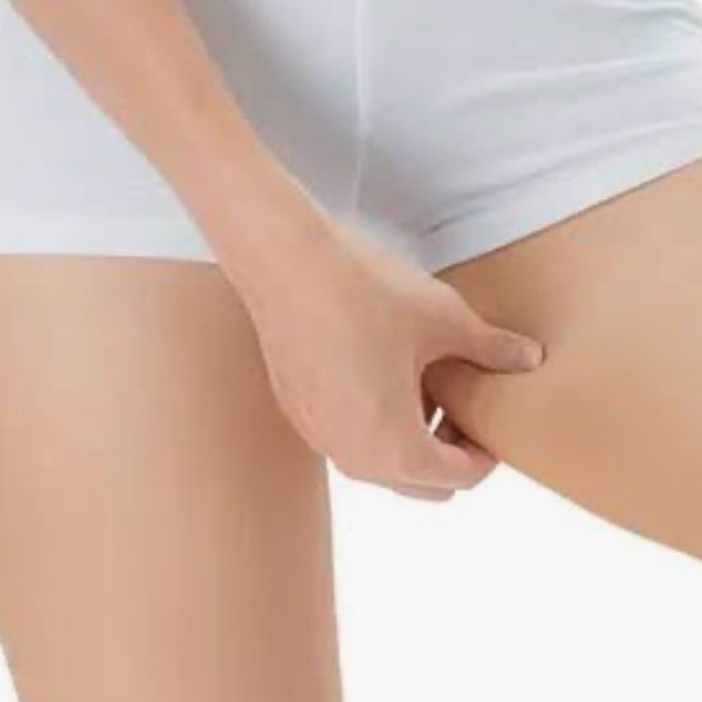 Inner Thigh Intimate Bleaching at NICHÉ in Lewisville, TX